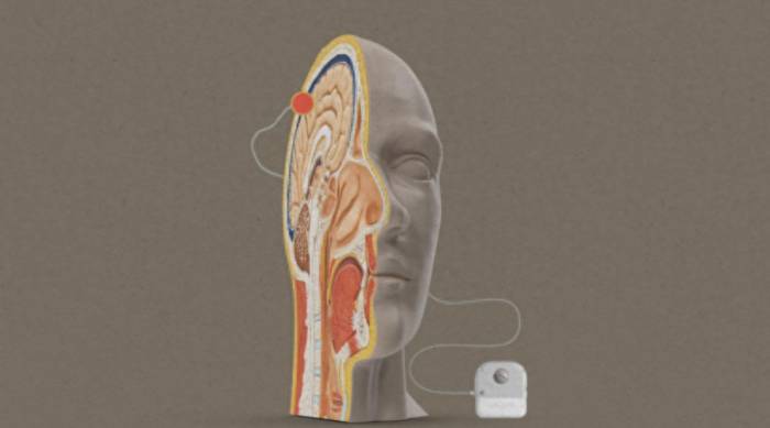 Motif Neurotech develops a brain-computer interface that only penetrates the sku